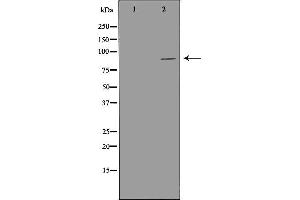 Western blot analysis of LoVo cell lysate, using PIBF1 Antibody. (PIBF1 antibody  (C-Term))