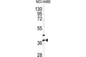 Western Blotting (WB) image for anti-Pantothenate Kinase 3 (PANK3) antibody (ABIN3003020)