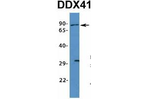 Host:  Rabbit  Target Name:  DDX41  Sample Type:  Human Fetal Muscle  Antibody Dilution:  1. (DDX41 antibody  (N-Term))