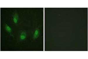 Immunofluorescence analysis of HeLa cells, using p53 (Ab-392) Antibody. (p53 antibody  (AA 344-393))
