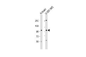 All lanes : Anti-MBD6 Antibody (C-term) at 1:1000 dilution Lane 1: human brain lysate Lane 2: U-251 MG whole cell lysate Lysates/proteins at 20 μg per lane.
