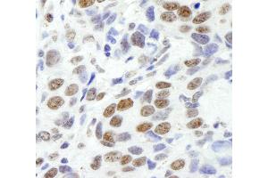 Immunohistochemistry (IHC) image for anti-Ewing Sarcoma Breakpoint Region 1 (EWSR1) (AA 100-150) antibody (ABIN7448557) (EWSR1 antibody  (AA 100-150))