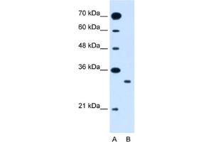 Western Blotting (WB) image for anti-Solute Carrier Family 25 (Mitochondrial Carrier: Glutamate), Member 22 (SLC25A22) antibody (ABIN2462766) (SLC25A22 antibody)