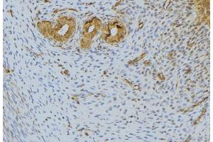 ABIN6276601 at 1/100 staining Human uterus tissue by IHC-P. (FGF10 antibody  (C-Term))