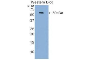 Western Blotting (WB) image for anti-Cadherin 4 (CDH4) (AA 667-916) antibody (ABIN1860421)