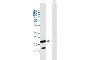 Western Blot analysis of VNN3 expression in transfected 293T cell line by VNN3 MaxPab polyclonal antibody. (VNN3 antibody  (AA 1-147))