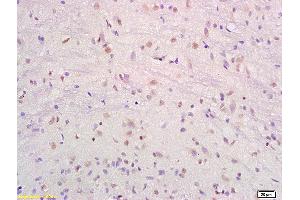 Formalin-fixed and paraffin embedded rat brain labeled with Anti-SRF/SAP2/MCM1 Polyclonal Antibody, Unconjugated (ABIN686017) at 1:200 followed by conjugation to the secondary antibody and DAB staining. (SRF antibody  (AA 101-250))