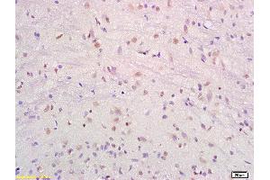 Formalin-fixed and paraffin embedded rat brain labeled with Anti-SRF/SAP2/MCM1 Polyclonal Antibody, Unconjugated (ABIN686017) at 1:200 followed by conjugation to the secondary antibody and DAB staining.
