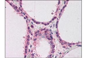 Human Thyroid (formalin-fixed, paraffin-embedded) stained with HNF4Aat 2 µg/ml followed by biotinylated anti-goat IgG secondary antibody, alkaline phosphatase-streptavidin and chromogen. (HNF4A antibody  (N-Term))