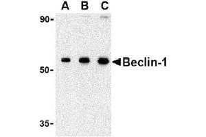 AP20054PU-N Beclin-1 antibody staining of 293 cell lysate by Western Blotting at (A) 0. (Beclin 1 antibody  (N-Term))