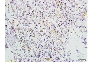 Formalin-fixed and paraffin embedded mouse lymphoma tissue labeled with Anti-TRAF3/CD40bp Polyclonal Antibody, Unconjugated  at 1:200 followed by conjugation to the secondary antibody and DAB staining