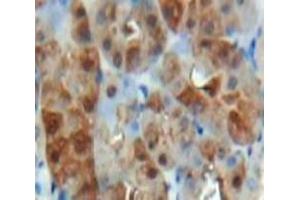 Used in DAB staining on fromalin fixed paraffin-embedded Kidney tissue (HIF1A antibody  (AA 575-826))