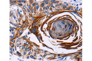 Immunohistochemistry (IHC) image for anti-Interleukin 18 Receptor 1 (IL18R1) (AA 19-320) antibody (ABIN3023691) (IL18R1 antibody  (AA 19-320))