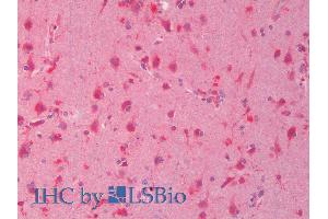 ABIN1590089 (5µg/ml) staining of paraffin embedded Human Cortex. (DVL1 antibody  (Internal Region))
