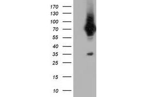 Western Blotting (WB) image for anti-Von Willebrand Factor A Domain Containing 5A (VWA5A) antibody (ABIN1501748) (VWA5A antibody)