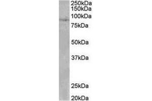 AP31953PU-N SETDB2 antibody staining of Human Heart lysate at 0. (SETDB2 antibody  (N-Term))