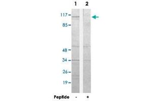 Western blot analysis of extracts from 293 cells, using CDCA2 polyclonal antibody . (CDCA2 antibody  (C-Term))