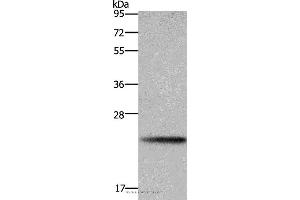 Western blot analysis of A549 cell, using BBC3 Polyclonal Antibody at dilution of 1:600 (PUMA antibody)