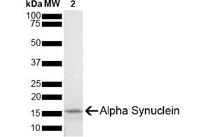 SDS-PAGE of ~14 kDa Mouse Recombinant Alpha Synuclein Protein Monomer (ABIN5651242, ABIN5651243 and ABIN5651244).