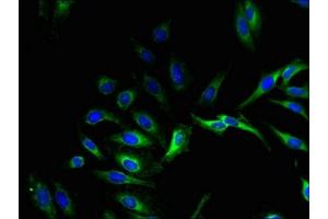 Immunofluorescent analysis of Hela cells using ABIN7164529 at dilution of 1:100 and Alexa Fluor 488-congugated AffiniPure Goat Anti-Rabbit IgG(H+L) (GPX8 antibody  (AA 41-209))