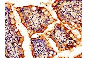 Immunohistochemistry of paraffin-embedded human small intestine tissue using ABIN7154893 at dilution of 1:100 (HSF2 antibody  (AA 79-173))