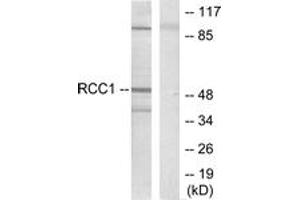 Western blot analysis of extracts from HepG2 cells, using Retinoic Acid Receptor beta Antibody. (Retinoic Acid Receptor beta antibody  (AA 331-380))