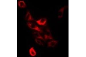 Immunofluorescent analysis of TC-PTP staining in Jurkat cells. (PTPN2 antibody)