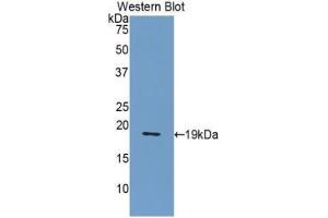 Western blot analysis of the recombinant protein. (NUCB2 antibody  (AA 108-246))