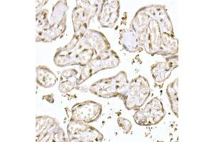 Immunohistochemistry of paraffin-embedded human colon using MUC2 Rabbit pAb (ABIN7268690) at dilution of 1:300 (40x lens). (MUC2 antibody  (AA 4850-4950))