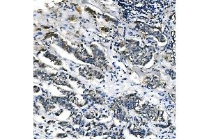 IHC analysis of PCK2 using anti-PCK2 antibody (ABIN7599509).