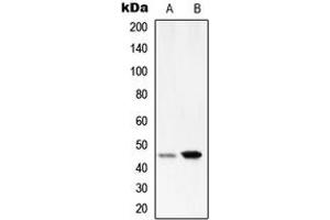 Western blot analysis of Serpin A1 expression in HepG2 (A), HeLa (B) whole cell lysates. (SERPINA1 antibody  (Center))