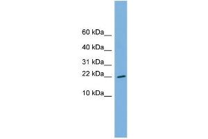 Human THP-1; WB Suggested Anti-RPS13 Antibody Titration: 0. (RPS13 antibody  (Middle Region))
