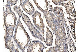 IHC analysis of Kinectin 1/KTN1 using anti-Kinectin 1/KTN1 antibody (ABIN7601096). (KTN1 antibody  (AA 283-827))