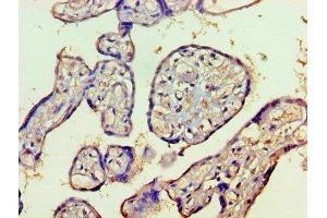 Immunohistochemistry of paraffin-embedded human placenta tissue using ABIN7155327 at dilution of 1:100 (HDAC8 antibody  (AA 1-377))