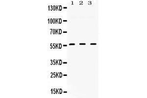 Western blot analysis of TGFBR1 expression in rat cardiac muscle extract ( Lane 1), mouse liver extract ( Lane 2) and HELA whole cell lysates ( Lane 3). (TGFBR1 antibody  (N-Term))