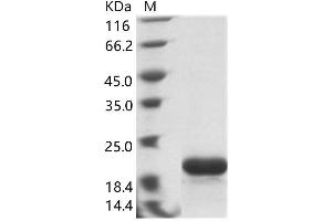 Western Blotting (WB) image for Zaire Ebola Virus Nucleoprotein (ZEBOV NP) protein (His tag) (ABIN7198932) (ZEBOV NP Protein (His tag))
