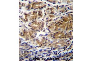 Immunohistochemistry (IHC) image for anti-Pyruvate Dehydrogenase Phosphatase Regulatory Subunit (PDPR) antibody (ABIN2996488) (PDPR antibody)