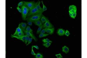 Immunofluorescence staining of HepG2 cells with ABIN7164836 at 1:100, counter-stained with DAPI. (PCSK9 antibody  (AA 462-595))