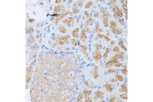 Immunohistochemistry of paraffin-embedded mouse pancreas using PLG1B antibody (ABIN6129428, ABIN6145724, ABIN6145725 and ABIN6221143) at dilution of 1:100 (40x lens).