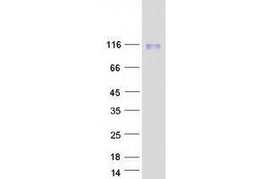 Validation with Western Blot