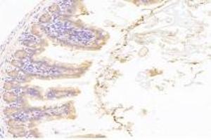 Immunohistochemistry analysis of paraffin-embedded mouse duodenum using,NT5C1B (ABIN7072861) at dilution of 1: 1200