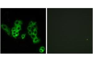 Immunofluorescence analysis of MCF7 cells, using Encephalopsin Antibody. (OPN3 antibody  (AA 161-210))