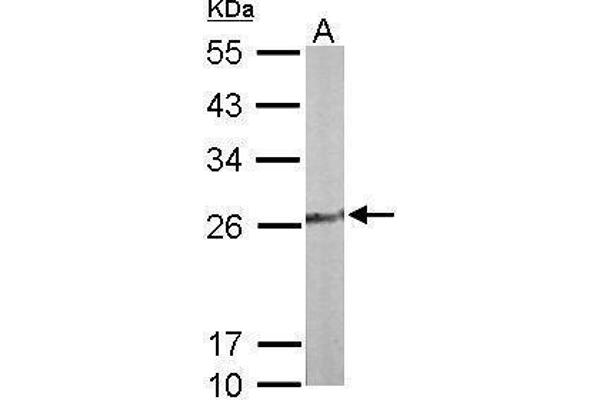 TPK1 抗体