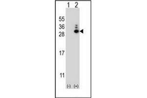 Western blot analysis of MOBKL1B (arrow) using MOBKL1B Antibody (N-term) Cat. (MOB1A antibody  (N-Term))