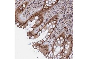 Immunohistochemical staining of human rectum with CCDC85A polyclonal antibody  shows strong nuclear positivity in glandular cells at 1:200-1:500 dilution. (CCDC85A antibody)