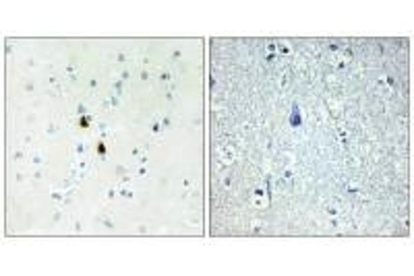 PKIA antibody