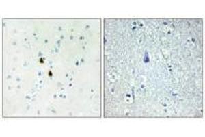 Immunohistochemistry analysis of paraffin-embedded human brain tissue, using TPD52 antibody. (PKIA antibody)