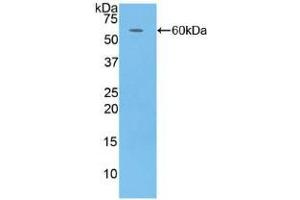 Western blot analysis of recombinant Human CFD. (Adipsin antibody  (AA 1-253))
