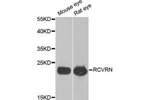Western blot analysis of extracts of various cell lines, using RCVRN antibody (ABIN5973805) at 1/1000 dilution. (Recoverin antibody)