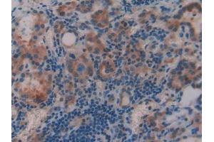 DAB staining on IHC-P; Samples: Human Thyroid Tissue